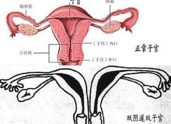 帶你了解什么是縱膈子宮，別再和雙子宮搞混了