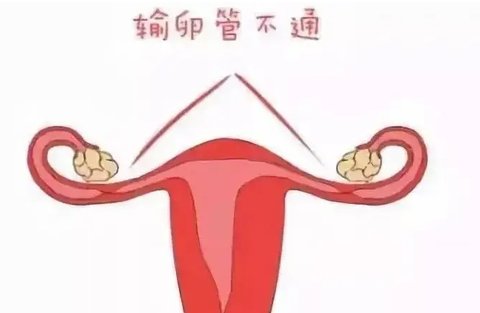 輸卵管