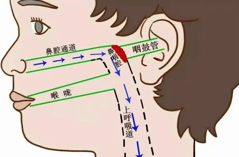 咽鼓管堵塞怎么疏通？咽鼓管堵塞自愈方法