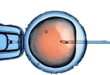 鮮胚與凍胚移植：揭秘哪個(gè)成功率更高？