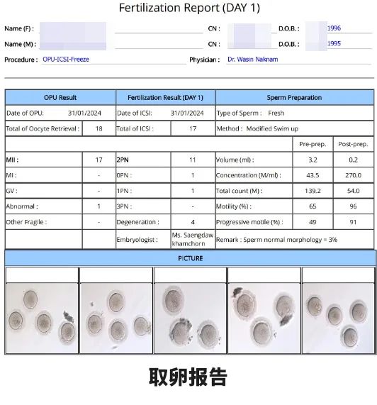 取卵報告