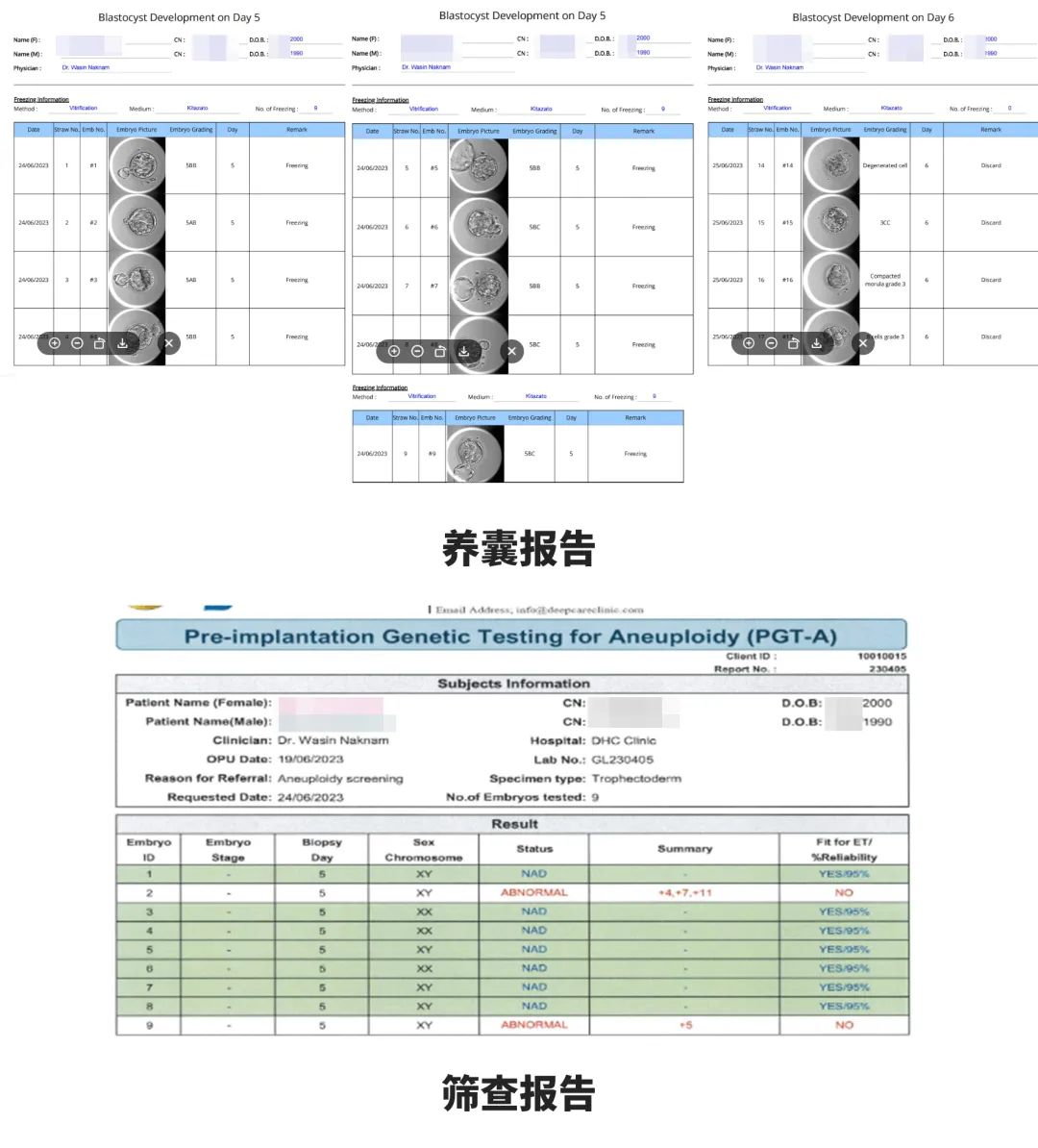 篩查報(bào)告